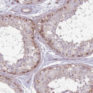 Anti-CCDC150 antibody produced in rabbit 