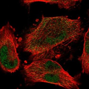 Anti-CCDC150 antibody produced in rabbit 