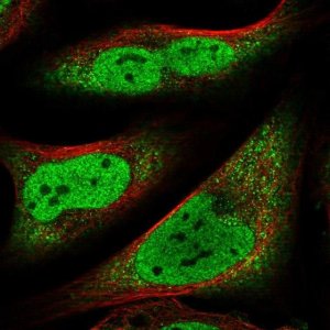 Anti-CCDC152 antibody produced in rabbit 
