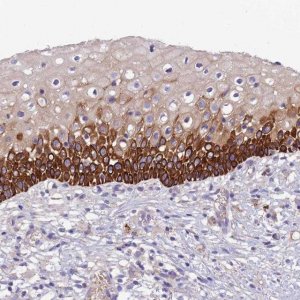 Anti-CCDC157 antibody produced in rabbit 