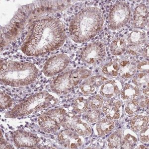 Anti-CCDC166 antibody produced in rabbit 