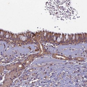 Anti-CCDC167 antibody produced in rabbit 