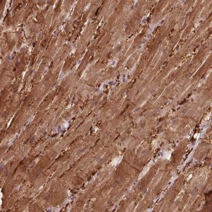 Anti-CCDC168 antibody produced in rabbit 