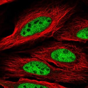 Anti-CCDC174 antibody produced in rabbit 