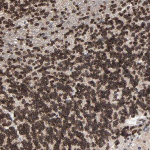 Anti-CCDC175 antibody produced in rabbit 