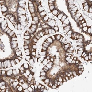 Anti-CCDC18 antibody produced in rabbit 