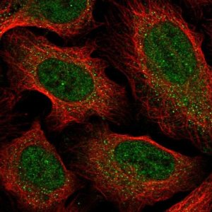 Anti-CCDC18 antibody produced in rabbit 