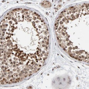 Anti-CCDC182 antibody produced in rabbit 