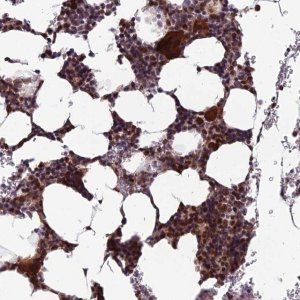 Anti-CCDC183 antibody produced in rabbit 