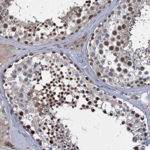 Anti-CCDC184 antibody produced in rabbit 