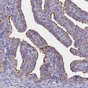 Anti-CCDC189 antibody produced in rabbit 