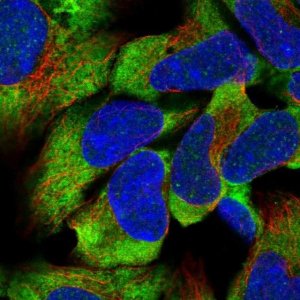 Anti-CCDC189 antibody produced in rabbit 
