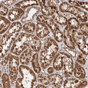 Anti-CCDC190 antibody produced in rabbit 