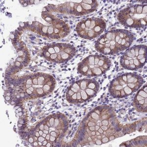 Anti-CCDC191 antibody produced in rabbit 