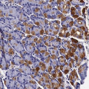 Anti-CCDC22 antibody produced in rabbit 