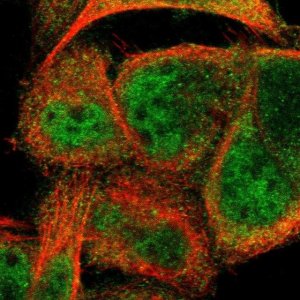 Anti-CCDC22 antibody produced in rabbit 
