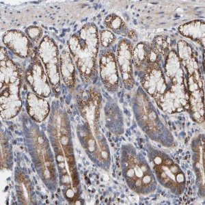 Anti-CCDC25 antibody produced in rabbit HPA023256-100UL