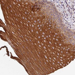 Anti-CCDC28A antibody produced in rabbit 
