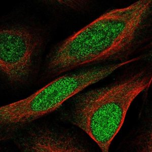 Anti-CCDC3 antibody produced in rabbit 