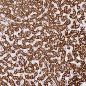 Anti-CCDC30 antibody produced in rabbit 