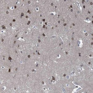 Anti-CCDC34 antibody produced in rabbit 
