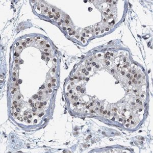 Anti-CCDC34 antibody produced in rabbit 