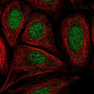 Anti-CCDC61 antibody produced in rabbit 