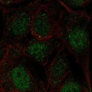 Anti-CCDC63 antibody produced in rabbit 