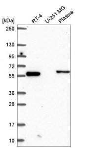 Anti-CCDC65 antibody produced in rabbit HPA057573-100UL