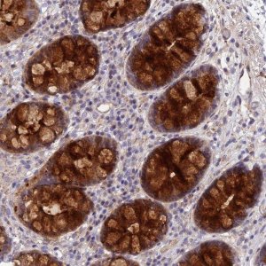 Anti-CCDC66 antibody produced in rabbit 