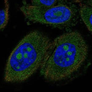 Anti-CCDC7 antibody produced in rabbit 