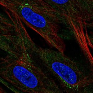Anti-CCDC71L antibody produced in rabbit 