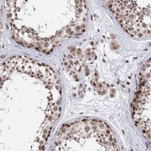Anti-CCDC77 antibody produced in rabbit 