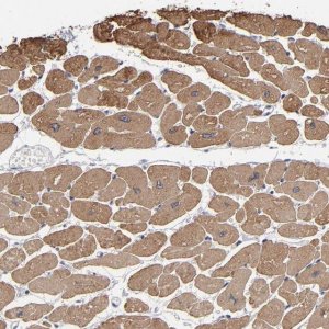 Anti-CCDC80 antibody produced in rabbit 