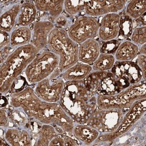 Anti-CCDC81 antibody produced in rabbit 