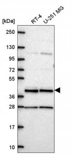 Anti-CCDC84 antibody produced in rabbit 