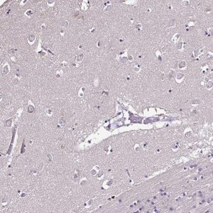 Anti-CCDC85C antibody produced in rabbit 