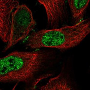Anti-CCDC85C antibody produced in rabbit 