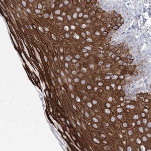 Anti-CCDC88A antibody produced in rabbit 