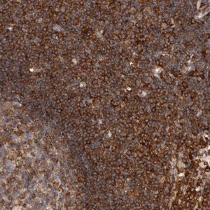 Anti-CCDC88B antibody produced in rabbit 