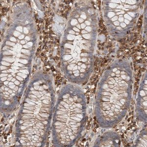 Anti-CCDC88B antibody produced in rabbit 