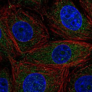 Anti-CCDC9 antibody produced in rabbit 