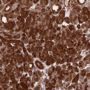 Anti-CCDC91 antibody produced in rabbit 
