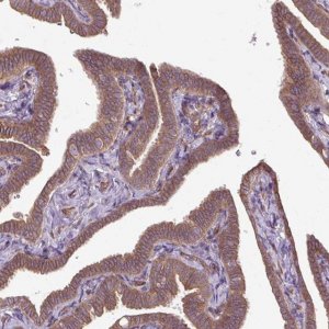 Anti-CCDC93 antibody produced in rabbit 