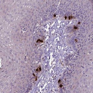 Anti-CCER2 antibody produced in rabbit 