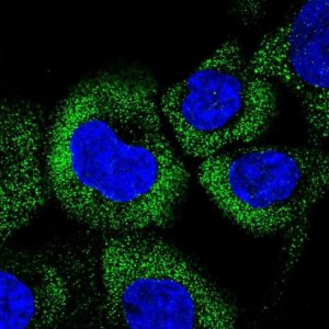 Anti-CCHCR1 antibody produced in rabbit 