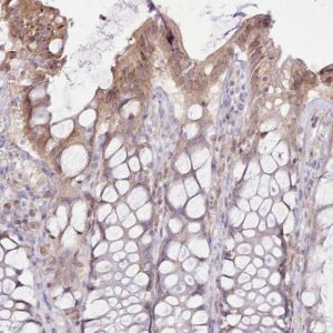 Anti-CCL1 antibody produced in rabbit 