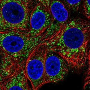 Anti-CCM2 antibody produced in rabbit 