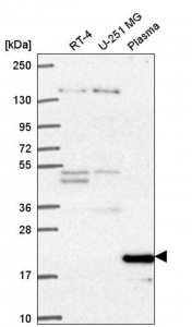 Anti-CCNC antibody produced in rabbit HPA069322-100UL
