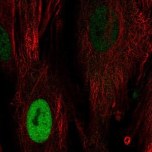 Anti-CCND1 antibody produced in rabbit 